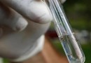 Faltam testes em meio à explosão de casos de dengue