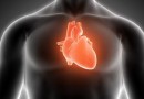 Por que casos de infarto em jovens têm aumentado