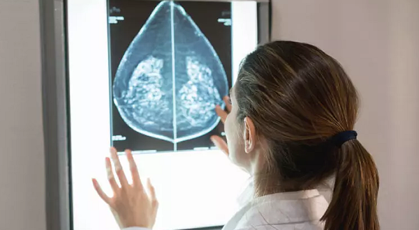 Casos de câncer de mama entre mulheres jovens mais que dobra no Brasil; veja explicações