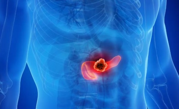 Cientistas usam combinação tripla de medicamentos e eliminam câncer de pâncreas em testes com animais