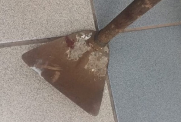 Filho agride a própria mãe com golpe de enxada