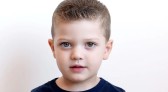 Heterocromia: a condição que deixa os olhos coloridos