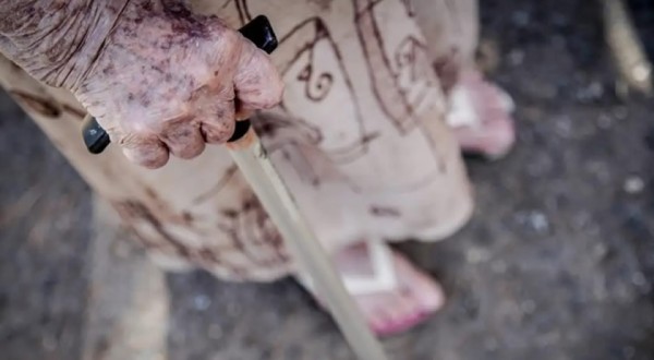 Ortopedistas alertam para risco de queda de idosos