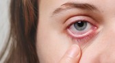 Sem sintomas iniciais, doença caracterizada por aumento da pressão nos olhos pode levar à cegueira