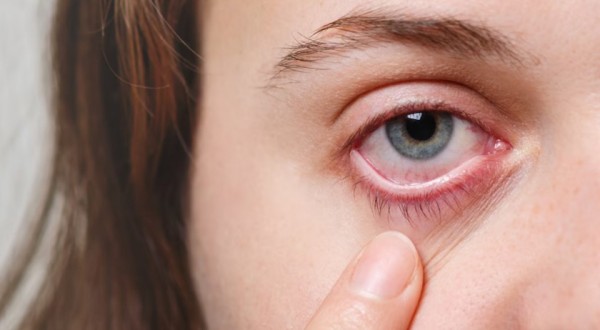 Sem sintomas iniciais, doença caracterizada por aumento da pressão nos olhos pode levar à cegueira