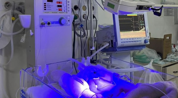 Francisco Beltrão lidera projeto pioneiro que protege cérebros de recém-nascidos no Paraná