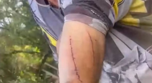 Agricultor de 76 anos sobrevive após lutar com onça-parda no Paraná