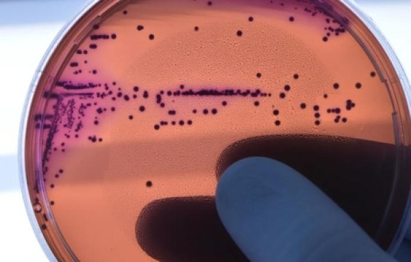 Abuso de antimicrobianos na pandemia pode ter agravado resistência a bactérias, aponta estudo