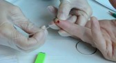 Mais de 23 mil pessoas foram diagnosticadas com hepatite em SC