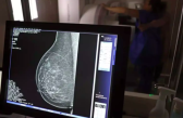 Vacina inédita contra o câncer de mama mostra eficácia de 75% e surpreende cientistas