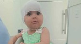 Bebê que sofre Plagiocefalia Posicional precisa de ajuda para tratamento em Capitão Leônidas Marques