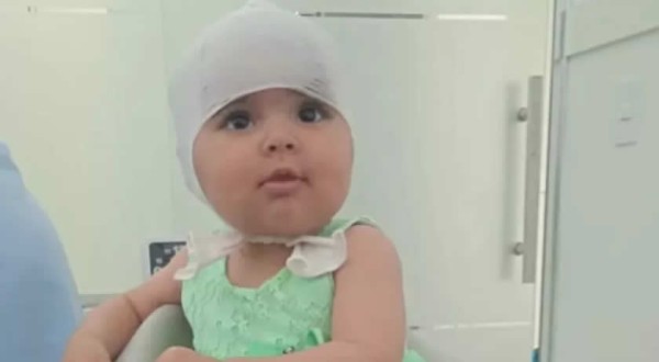 Bebê que sofre Plagiocefalia Posicional precisa de ajuda para tratamento em Capitão Leônidas Marques