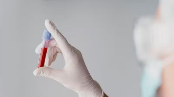 Novo exame de sangue é promessa para detectar câncer de cólon