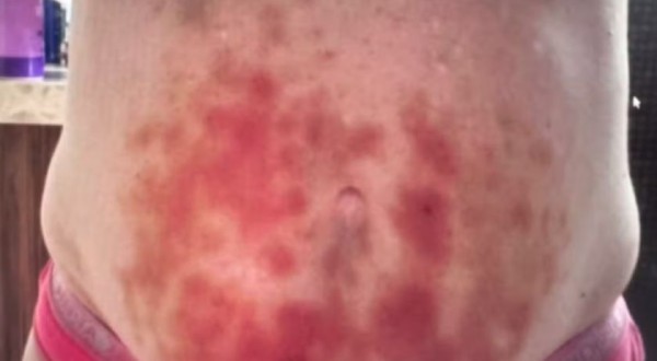 "Terapeuta holística" é investigada por fazer procedimentos médicos sem autorização e prometer resolver doenças que não têm cura