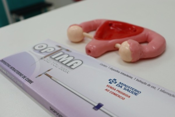 Mulheres podem ter acesso ao DIU de forma gratuita através do SUS