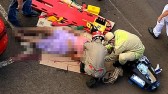 Mulher fica ferida ao ser atropelada por motocicleta