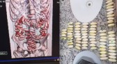 Duas pessoas são presas no Aeroporto do Recife com 214 cápsulas de cocaína no estômago