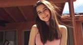 Jovem sofre de alergia à água, caso raro que acontece com uma a cada 200 milhões de pessoas