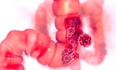 Hábito alimentar comum no Brasil está ligado à incidência de câncer no intestino, aponta estudo