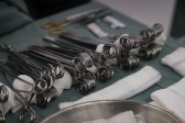 Estado viabiliza cirurgia inédita em paciente jovem com tumor ósseo pelo SUS