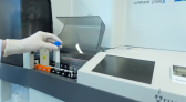Exame de sangue para identificar Alzheimer chega ao Brasil e custa cerca de R$ 3 mil