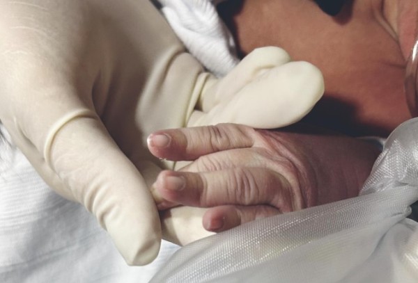 Bebê com 2 dias de vida é salvo após se engasgar com leite materno