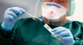 Pesquisadores da USP testam técnica que diagnostica câncer em amostras de saliva e urina