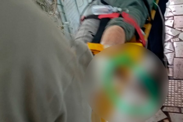 Idosa sofre queda e tem perna transfixada por vergalhão