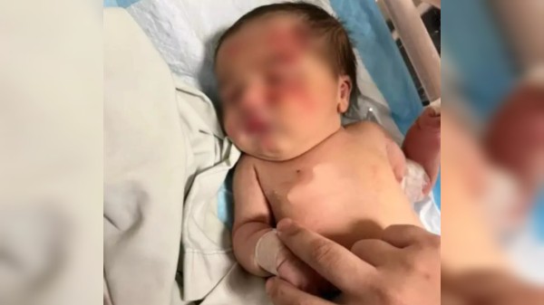 Bebê é abandonado em lixo e é salvo por cachorro de rua
