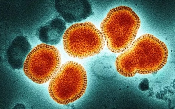 SC confirma 17 casos de variação da Influenza A (H3N2), conhecida como Gripe K