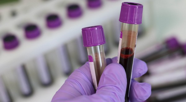 Alerta para o diagnóstico precoce de anemia e leucemia, doenças ligadas ao sangue