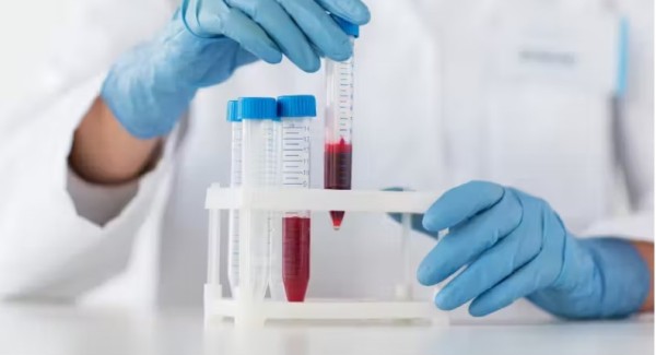 Cientistas descobrem proteínas que podem detectar câncer 7 anos antes do diagnóstico