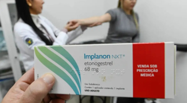 Método contraceptivo que pode custar até R$ 4 mil chega no SUS