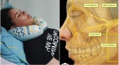 Ação entre amigos tenta ajudar jovem que sofre de Neuralgia do Trigêmeo
