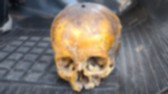 Crânio é encontrado em lixo no Bairro Vila Nova