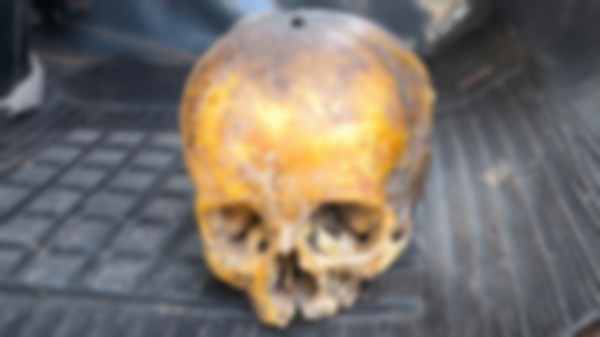 Crânio é encontrado em lixo no Bairro Vila Nova