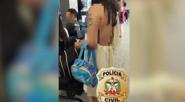 Madrasta acusada de queimar mão de criança com colher quente é presa