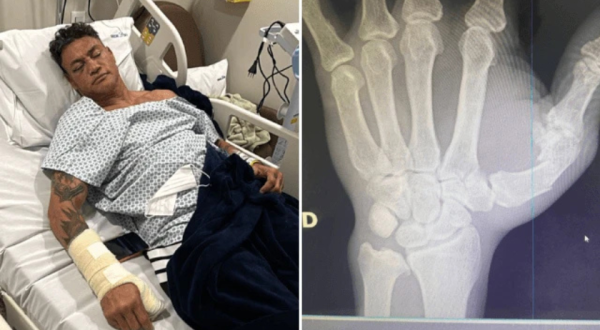 Popó faz cirurgia após briga generalizada em luta com Wanderlei Silva