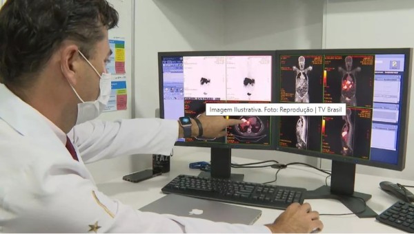 Câncer de intestino: SC deve registrar mais de 2,4 mil casos da doença