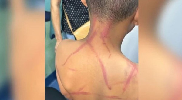 Casal de pastores é preso suspeito de torturar criança de 9 anos