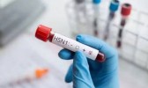 Brasil tem novos casos de gripe aviária e número de focos sobe para 64