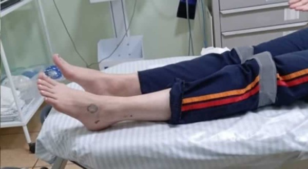 Profissional do SAMU é mordida por cão durante atendimento de mulher armada com faca