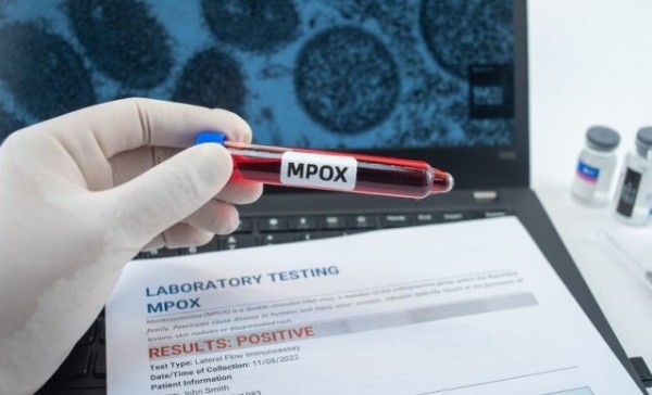 Casos de mpox no Brasil chegam a 945 e já superam o total de 2023