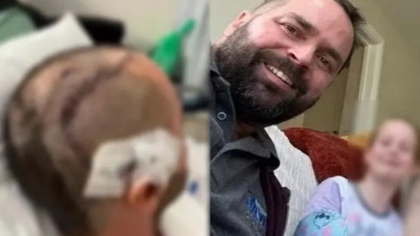 Homem descobre tumor cerebral grave após confundir sintomas com gripe
